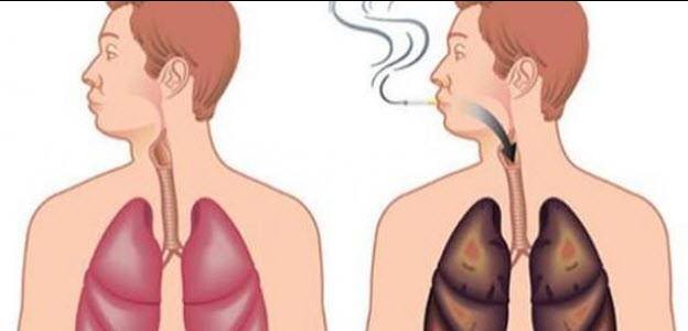 الفرق بين رئة الشخص السليم وبين المدخن