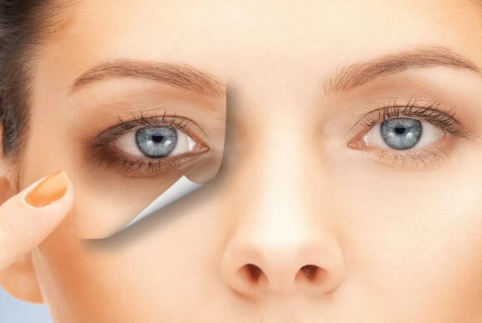 وصفات علاج الهالات السوداء حول العين