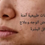 وصفات لتبييض الوجه وعلاج مشاكل البشرة طبيعية وآمنة