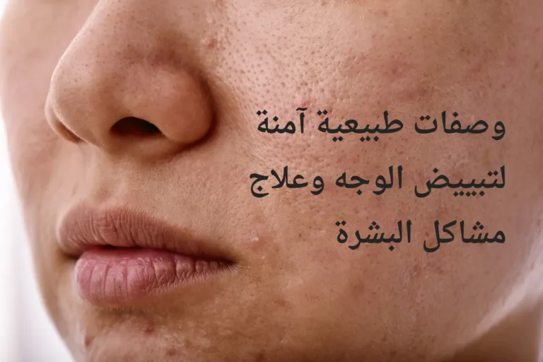 وصفات لتبييض الوجه وعلاج مشاكل البشرة طبيعية وآمنة