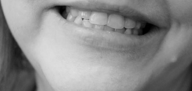 علاج السواد حول الفم