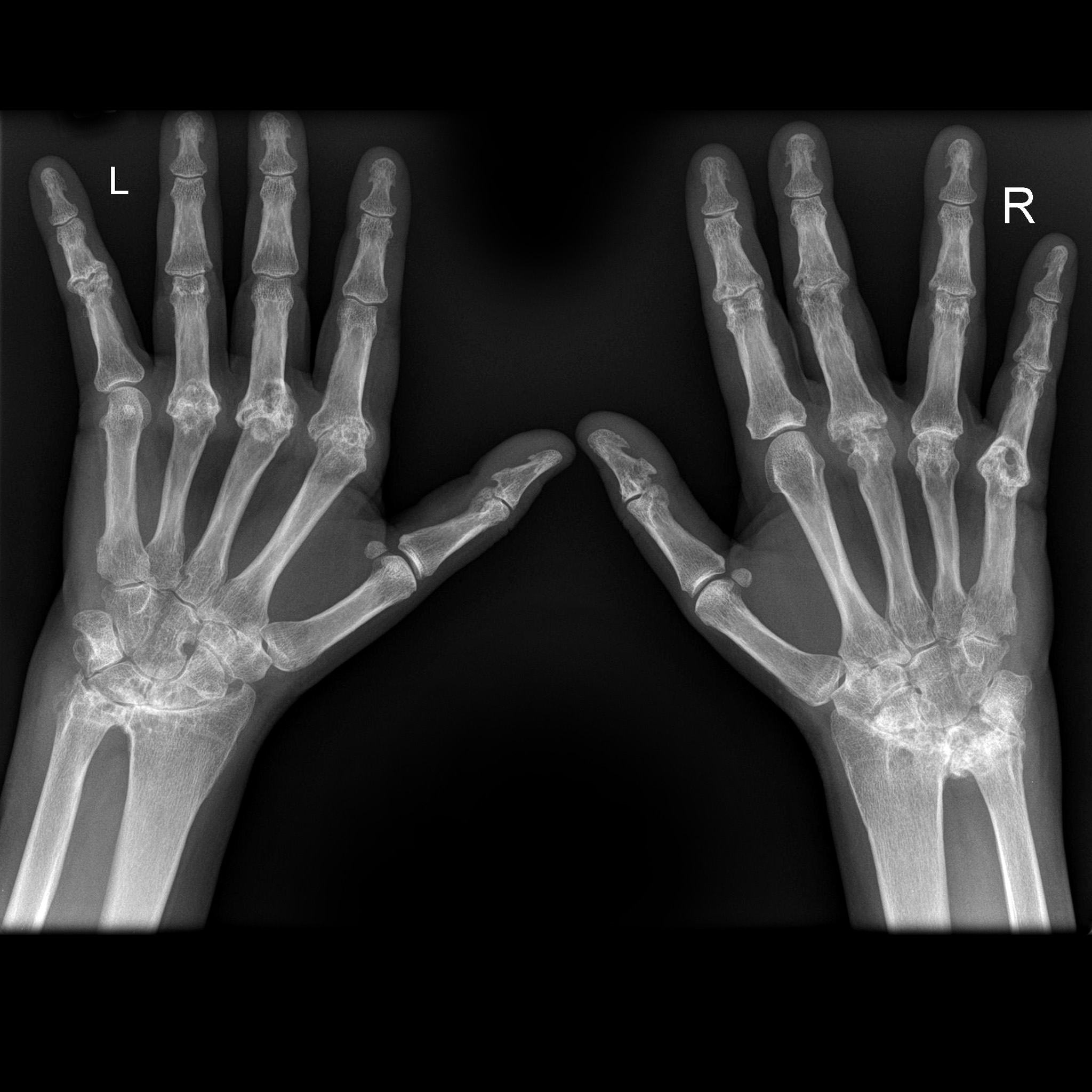 استخدام الأشعة السينية لتشخيص المرض