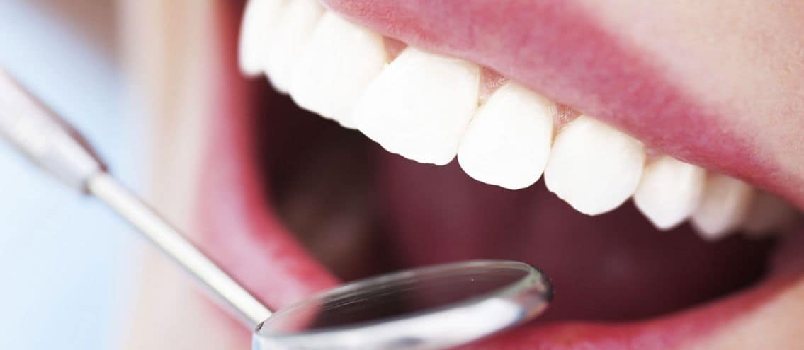 فوائد عملية زراعة الأسنان