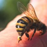 العلاج بلسعة النحل