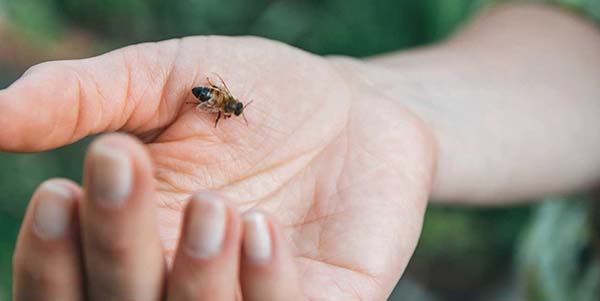 علاج لسعة النحل طبيًا أو منزليًا
