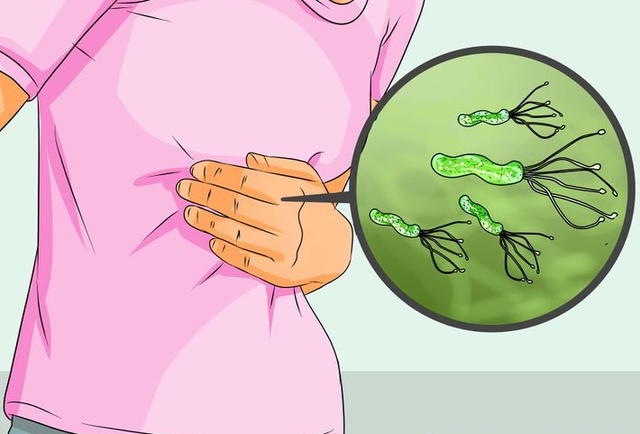 أعراض البكتريا الحلزونية
