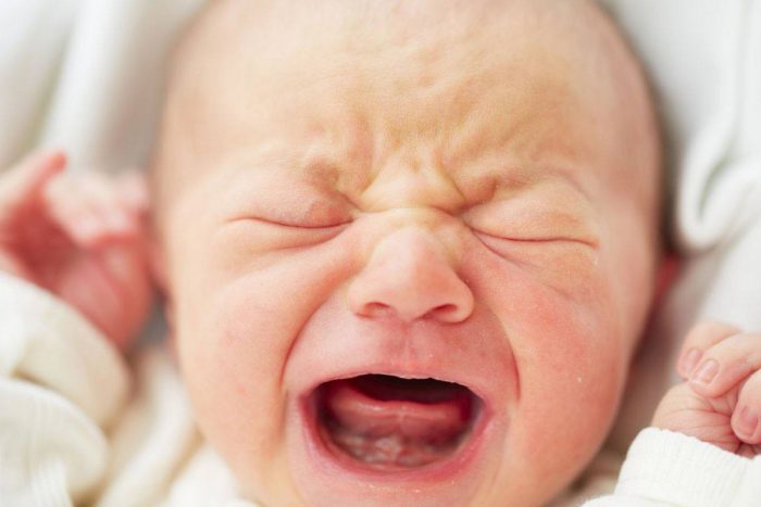 أعراض اليرقان عند الأطفال حديثي الولادة