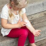 علاج أكزيما الأطفال طبيعيًا