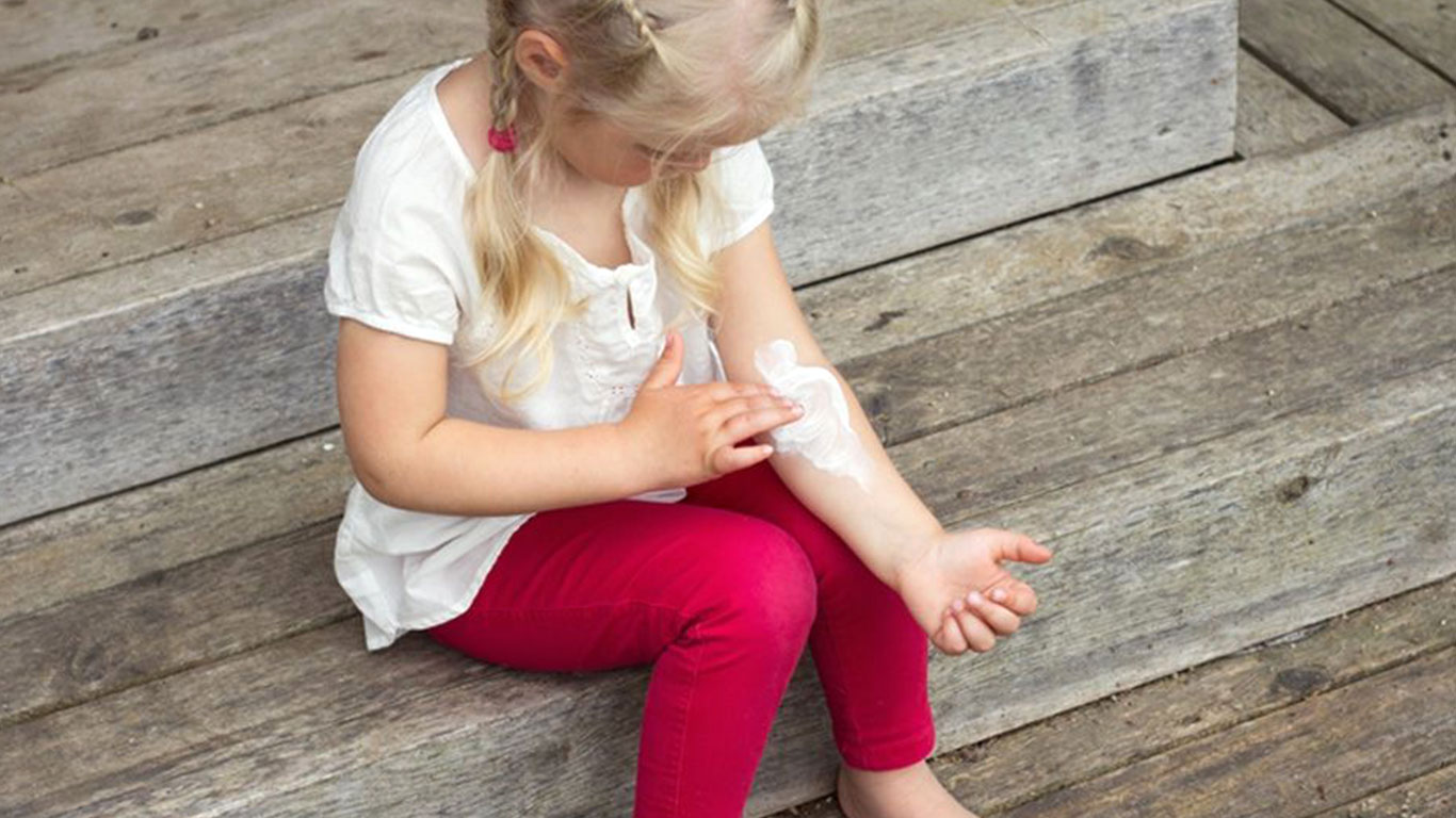 علاج أكزيما الأطفال طبيعيًا والمشاكل الجلدية الأخرى