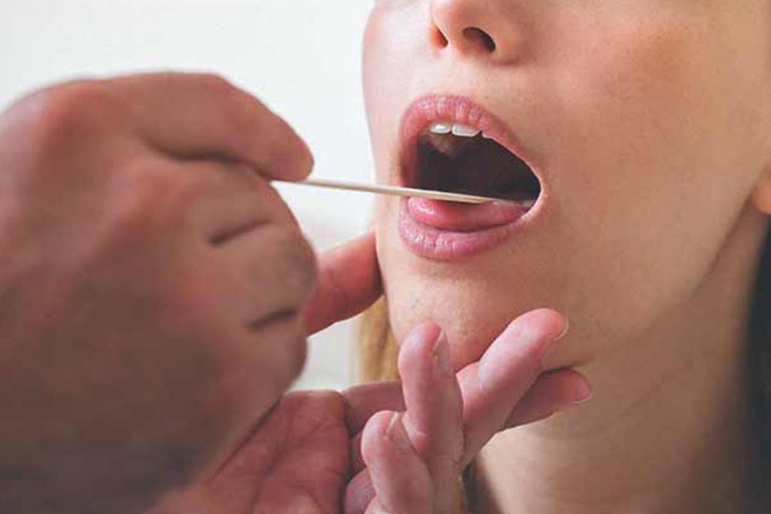 أسباب الالتهاب في الفم واللسان والحلق والعلاج