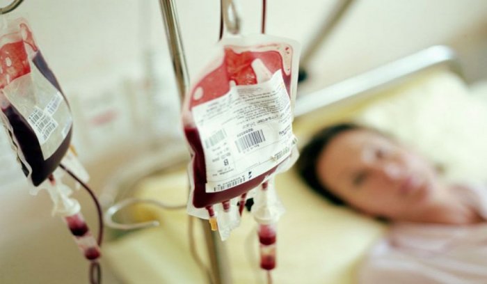 انخفاض عدد الصفائح الدموية – الأسباب والأعراض وطرق العلاج