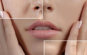 إغلاق مسامات الوجه للبشرة الدهنية والتخلص منها بـ 3 أمور بسيطة وفعالة جدًا