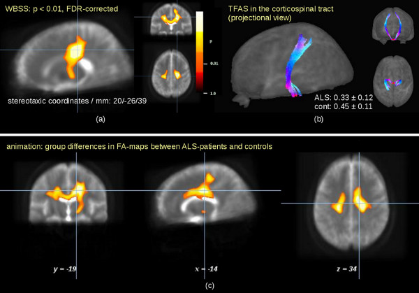 الدماغ في ترجيح T1 و T2 و PD