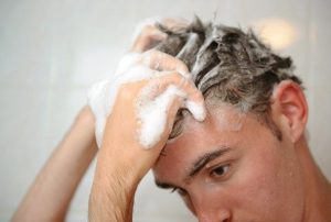 صدفية الشعر – كيف يمكن علاجها