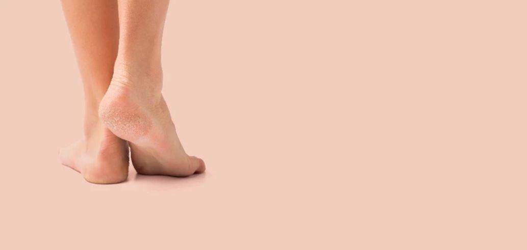 علاج تشقق الكعبين حتى لا تعاني أثناء المشي مع أقدام مثل أوراق الصنفرة