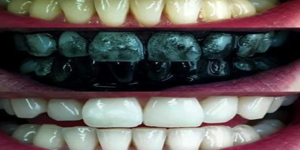 بودرة الفحم لتنظيف الأسنان