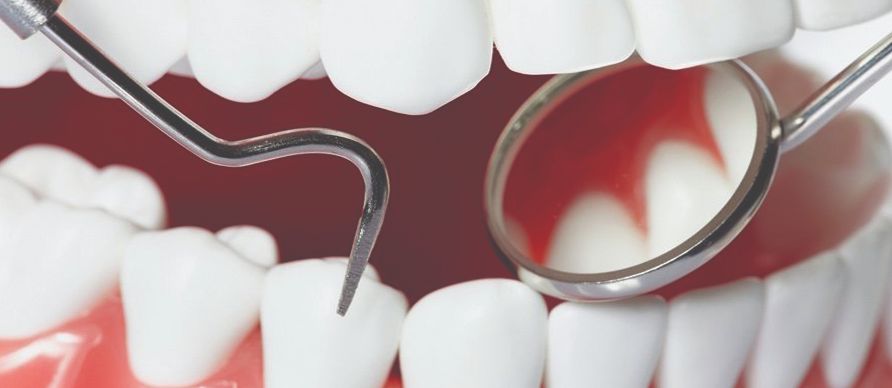متى عليك زيارة طبيب الأسنان؟