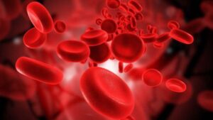 اسباب ارتفاع نسبة الحديد في الدم