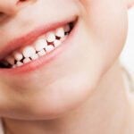 سقوط الاسنان اللبنية 1