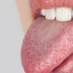 أسباب جفاف الفم واللسان والحلق