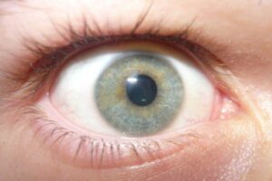 هل جفاف العين يسبب العمى؟ لماذا يجب آخذ الأمر على محمل الجد؟