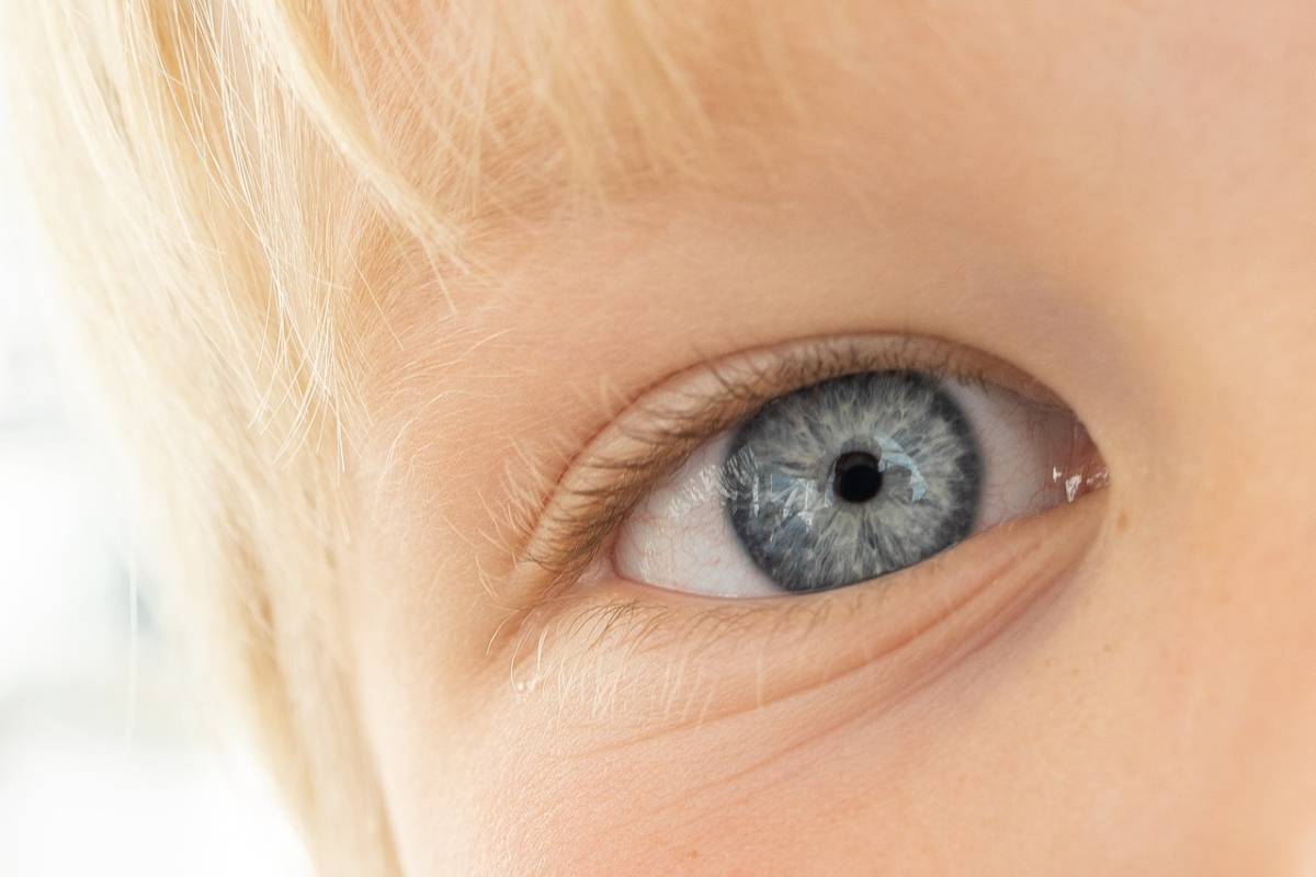 للاطفال احمرار العين أسباب احمرار