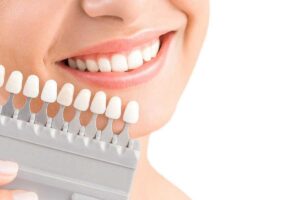 تركيبات الزيركون للأسنان – المزايا والعيوب والتكلفة المتوقعة